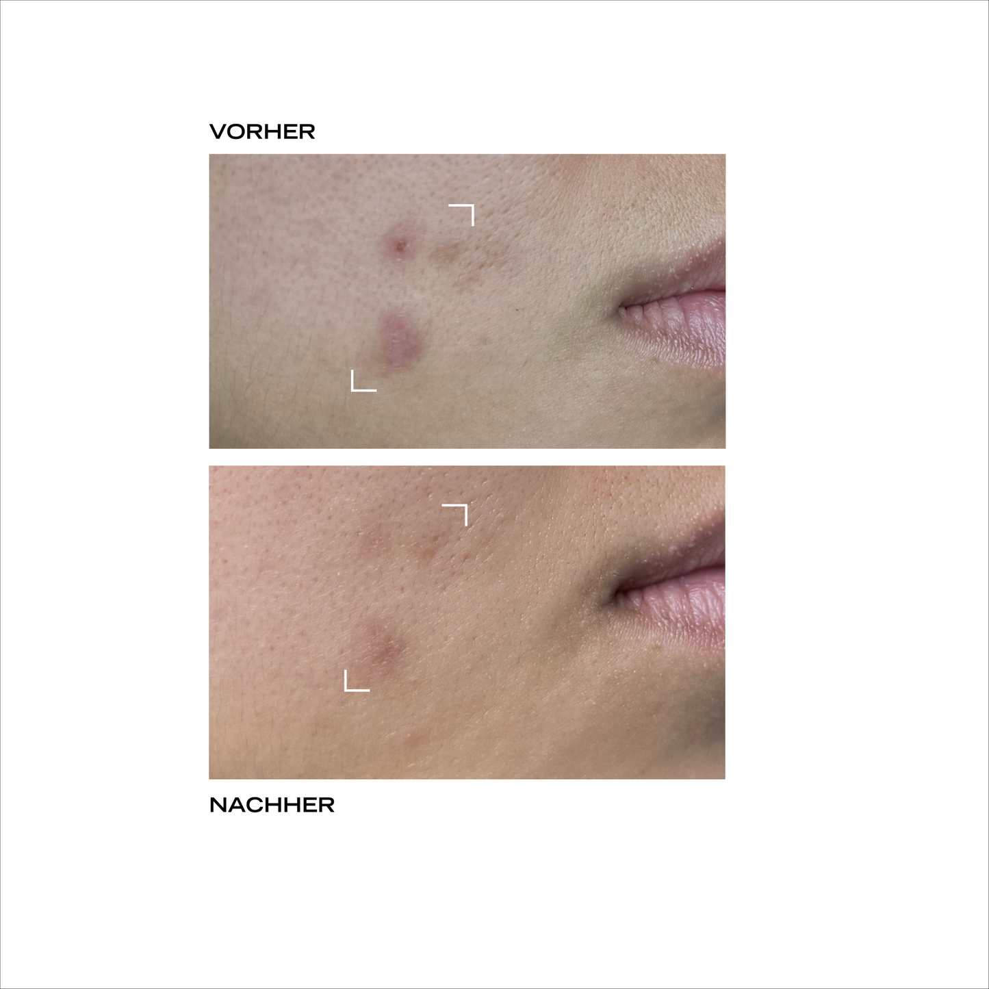 Serum Peeling DE