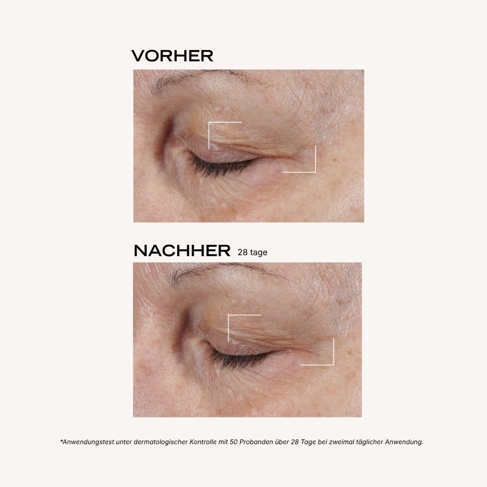 Crème Yeux Jeunesse DE