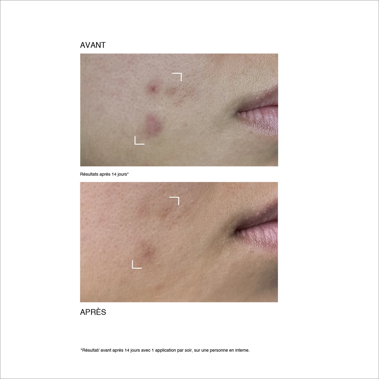 Duo rénovateur anti-imperfections