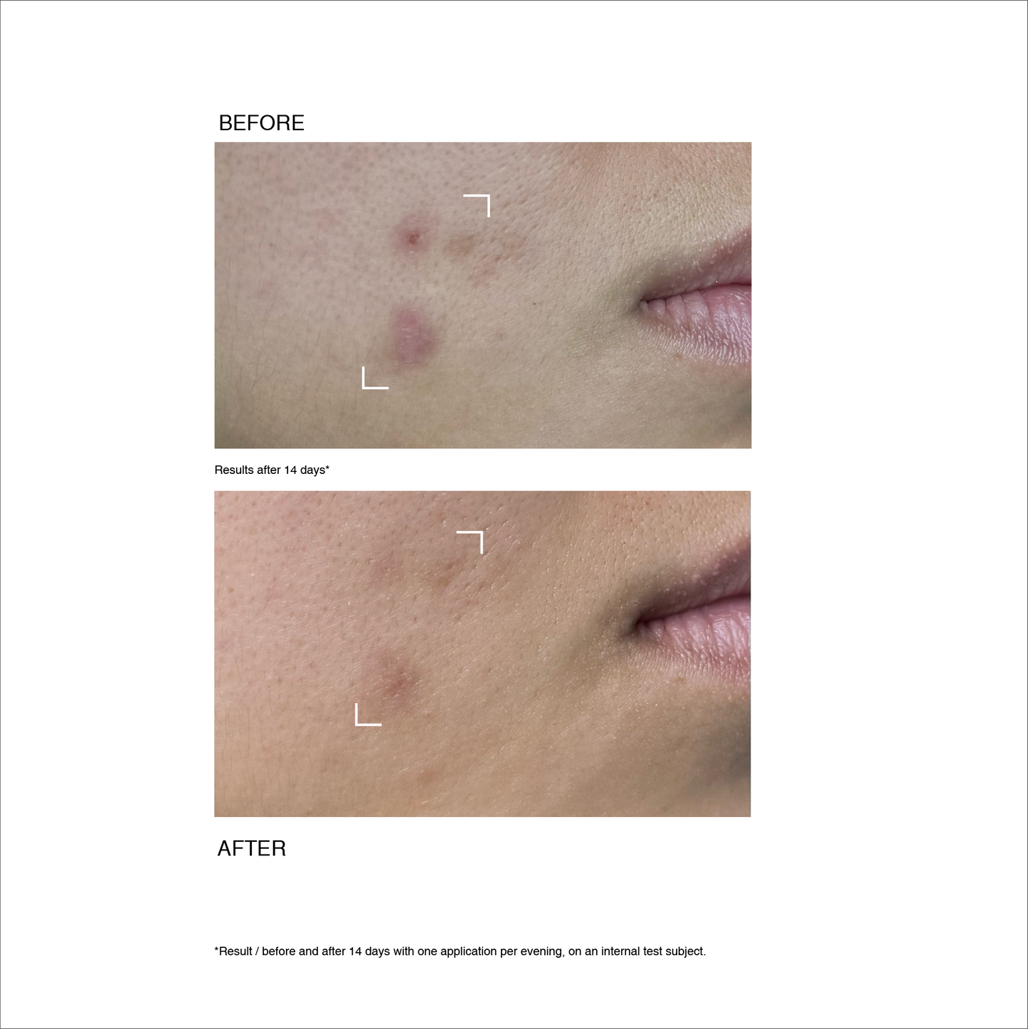 Sérum Peeling EN
