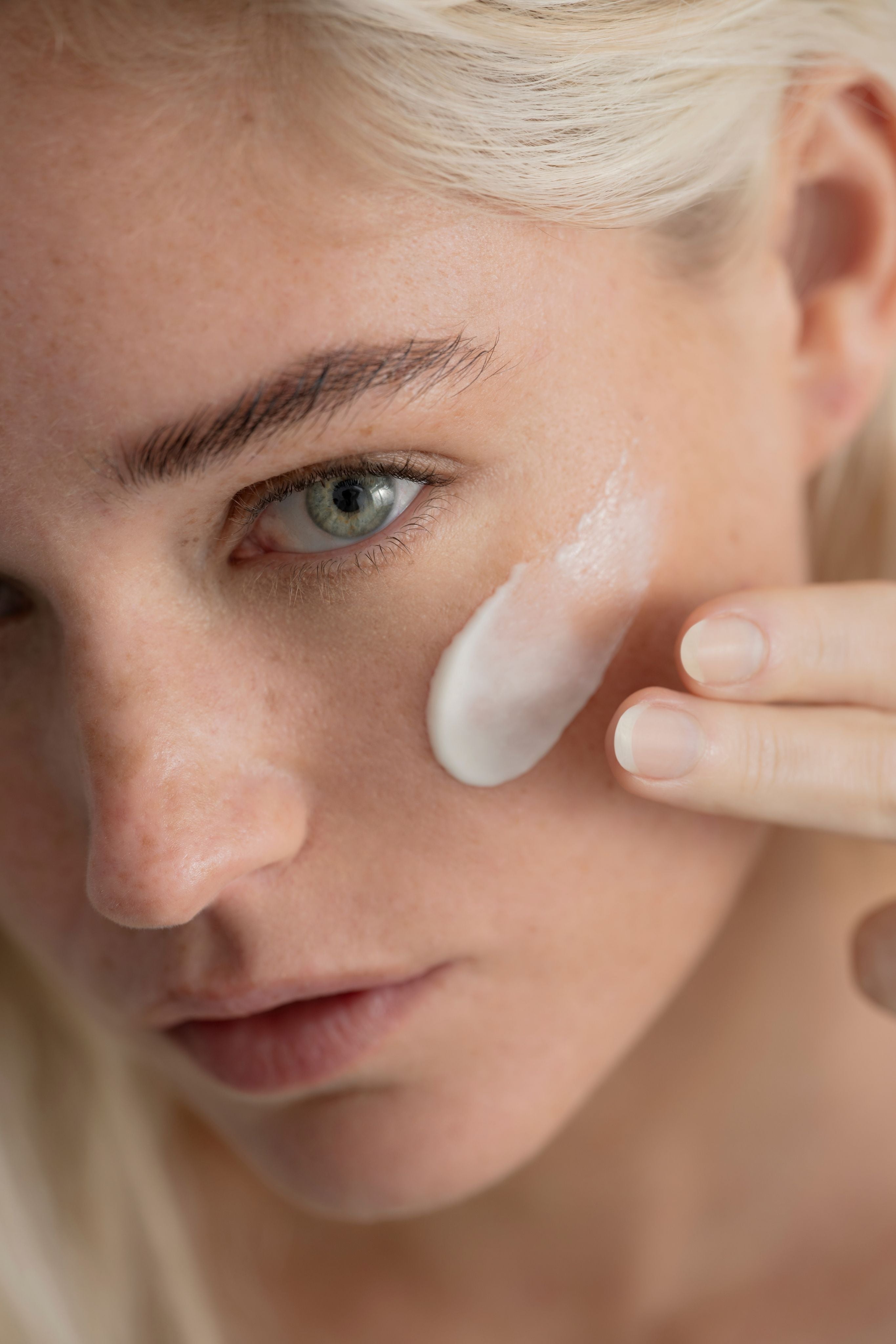 Blackheads in the T-zone, what to do?
