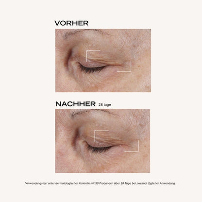 Crème Yeux Jeunesse DE