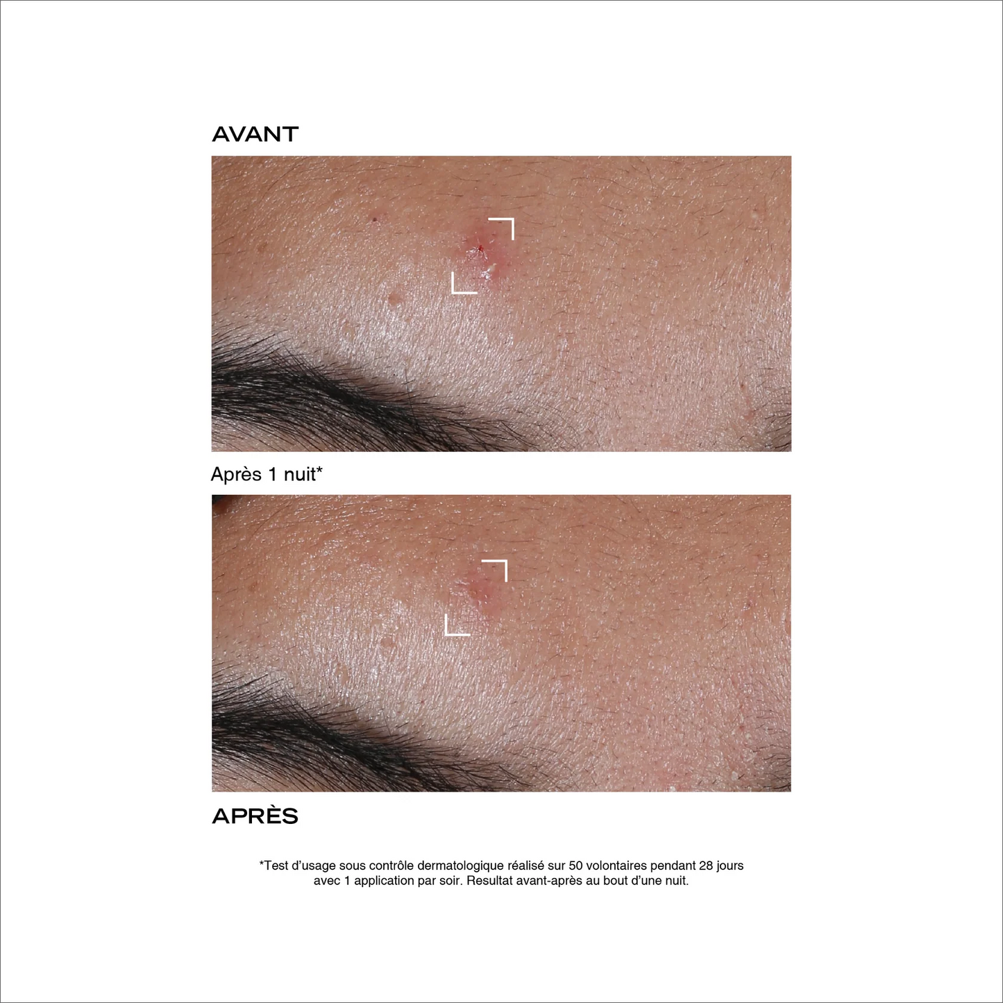 Duo rénovateur anti-imperfections