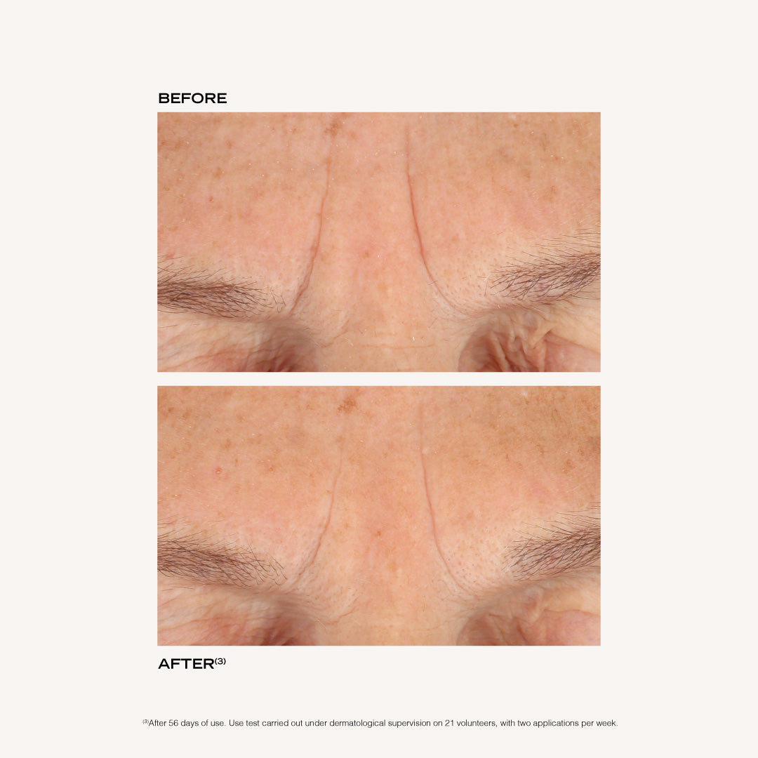BEFORE AFTER EN