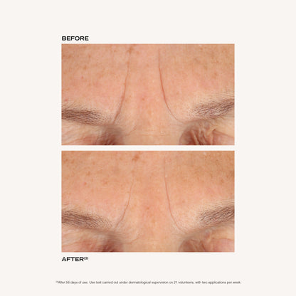 BEFORE AFTER EN